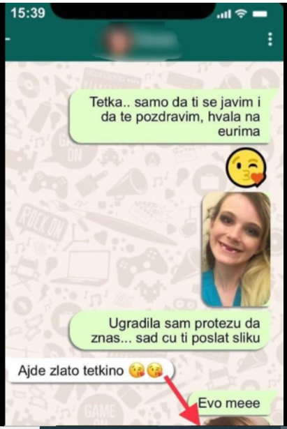 TETKA IZ NJEMAČKE MI JE POSLALA 500 EURA DA NAPRAVIM ZUBE: Kad je vidjela kako SADA izgledam VRISNULA JE, uvjerite se i sami (FOTO)