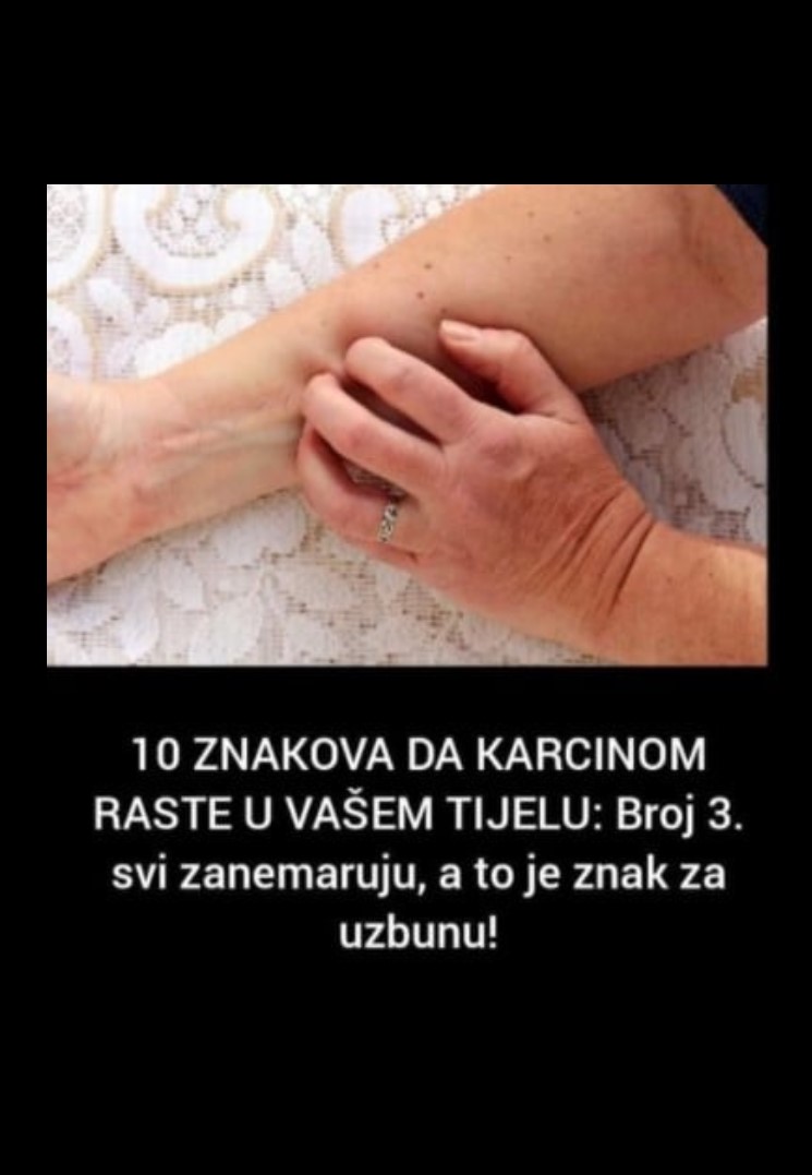 10 ZNAKOVA DA KARCINOM RASTE U VAŠEM TIJELU: Broj 3. svi zanemaruju, a to je znak za uzbunu!