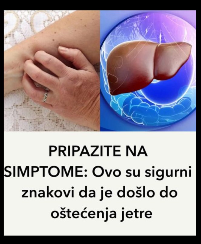 PRIPAZITE NA SIMPTOME: Ovo su sigurni znakovi da je došlo do oštećenja jetre