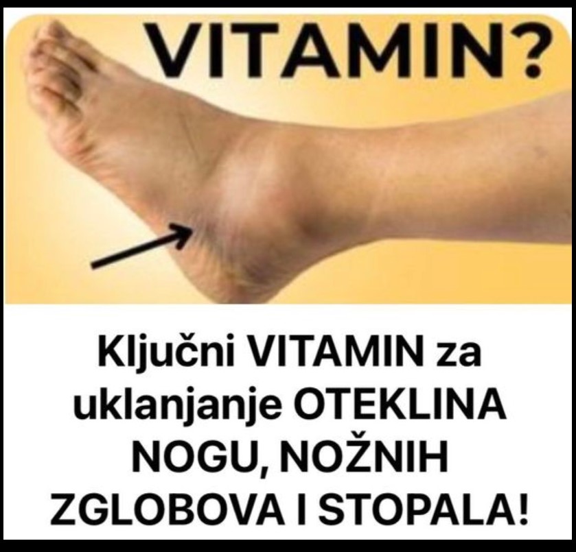 Ključni VITAMIN Za Uklanjanje OTEKLINA NOGU, NOŽNIH ZGLOBOVA I STOPALA!