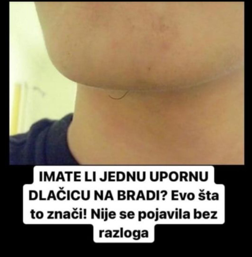 IMATE LI JEDNU UPORNU DLAČICU NA BRADI? Evo šta to znači! Nije se pojavila bez razloga