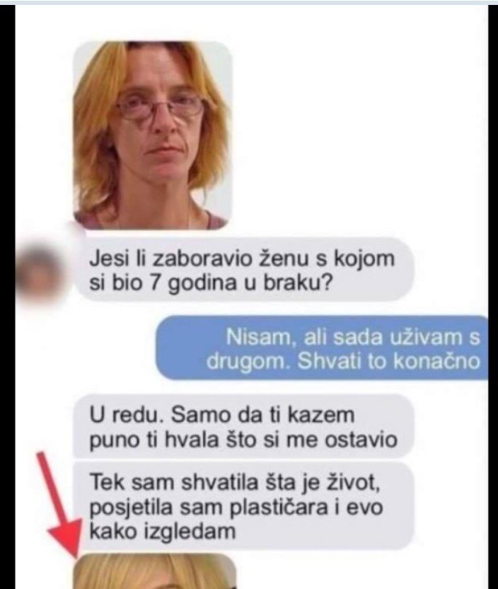 BIVŠI MUŽ ME OSTAVIO NAKON 7 GODINA BRAKA JER SAM SE PRORUŽNILA: A kad je vidio MOJU NOVU SLIKU, oči su mu ispale! (FOTO)