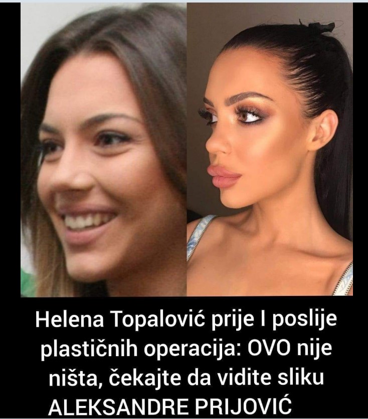 OVO JE TOPALKOVA KĆERKA PRIJE PLASTIČNIH OPERACIJA: Ali čekajte da vidite lice ALEKSANDRE PRIJOVIĆ!