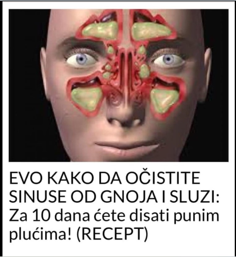 EVO KAKO DA OČISTITE SINUSE OD GNOJA I SLUZI: Za 10 dana ćete disati punim plućima! (RECEPT)