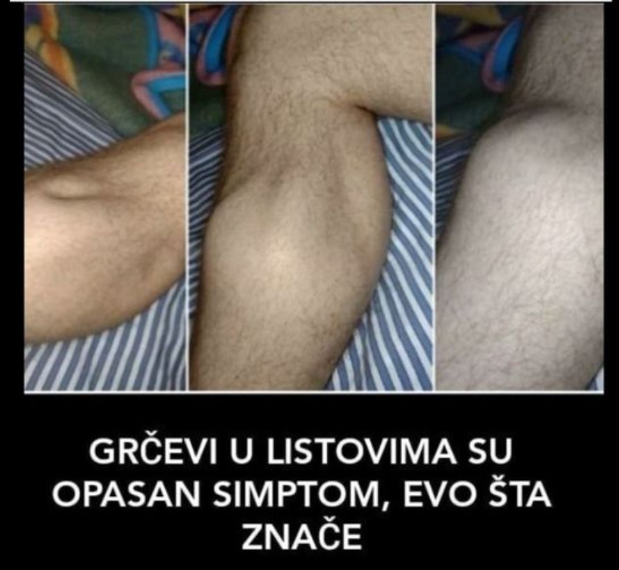 NOĆU VAS BUDE GRČEVI U NOGAMA? GRČEVI U LISTOVIMA SU OPASAN SIMPTOM: Evo na šta ukazuje bol – MORATE ZNATI