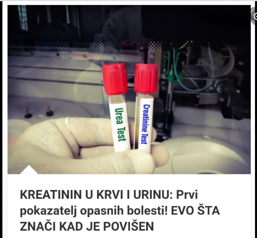 KREATININ U KRVI I URINU: Prvi pokazatelj opasnih bolesti! EVO ŠTA ZNAČI KAD JE POVIŠEN