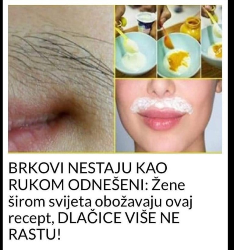 BRKOVI NESTAJU KAO RUKOM ODNEŠENI: Žene širom svijeta obožavaju ovaj recept, DLAČICE VIŠE NE RASTU!