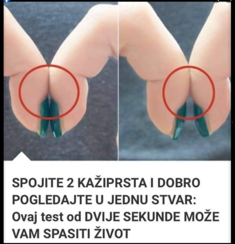 SPOJITE 2 KAŽIPRSTA I DOBRO POGLEDAJTE U JEDNU STVAR: Ovaj test od DVIJE SEKUNDE MOŽE VAM SPASITI ŽIVOT