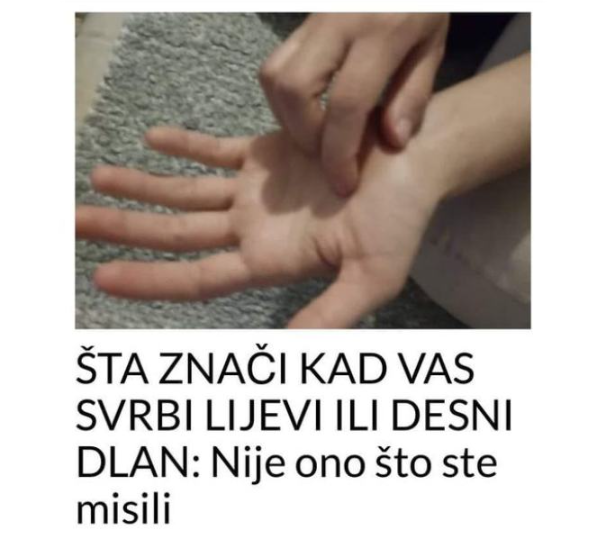 ŠTA ZNAČI KAD VAS SVRBI LIJEVI ILI DESNI DLAN: Sljedeći put ćete makar znati ŠTA VAS ČEKA!