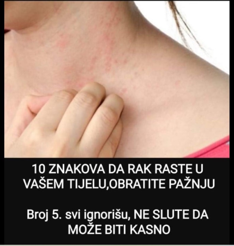 10 ZNAKOVA DA KARCINOM RASTE U VAŠEM TIJELU, OBRATITE PAŽNJU: Broj 5. svi ignorišu, NE SLUTE DA MOŽE BITI KASNO