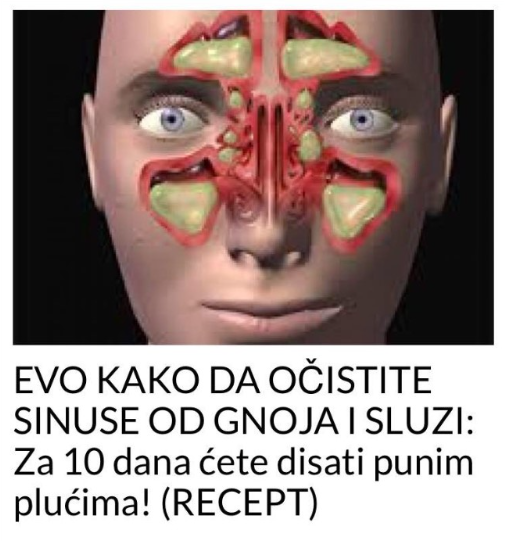 EVO KAKO DA OČISTITE SINUSE OD GNOJA I SLUZI: Za 10 dana ćete disati punim plućima! (RECEPT)