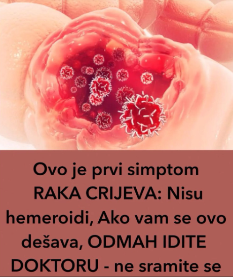 Ovo je prvi simptom RAKA CRIJEVA: Nisu hemeroidi, ako vam se ovo dešava, ODMAH IDITE DOKTORU – ne sramite se