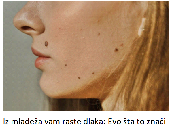 Iz mladeža vam raste dlaka: Evo šta to znači