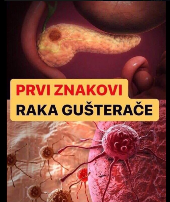 KARCINOM GUŠTERAČE: Ovo je 8 simptoma koje ne smijete ignorisati, ako ih primijetite HITNO KOD DOKTORA DOK NIJE KASNO!