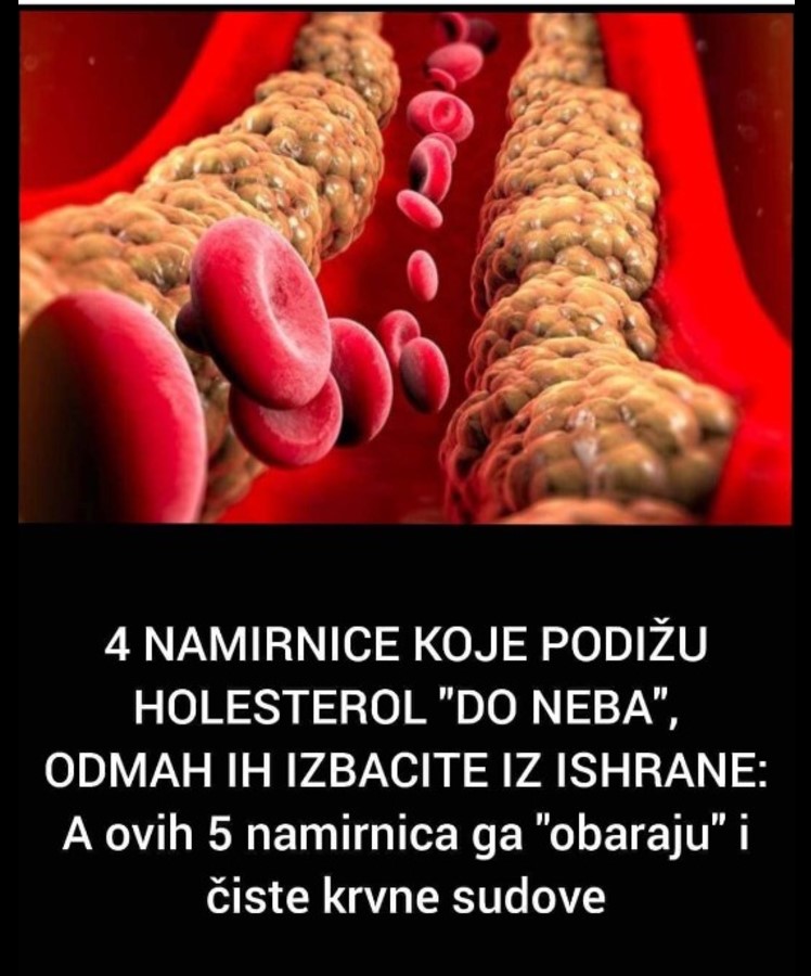 4 NAMIRNICE KOJE PODIŽU HOLESTEROL “DO NEBA”, ODMAH IH IZBACITE IZ ISHRANE: A ovih 5 namirnica ga “obaraju” i čiste krvne sudove