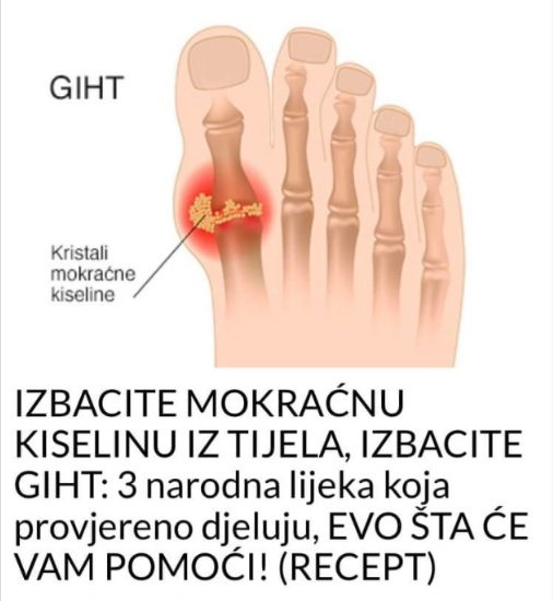 IZBACITE MOKRAĆNU KISELINU IZ TIJELA, IZBACITE GIHT: 3 narodna lijeka koja provjereno djeluju, EVO ŠTA ĆE VAM POMOĆI! (RECEPT)