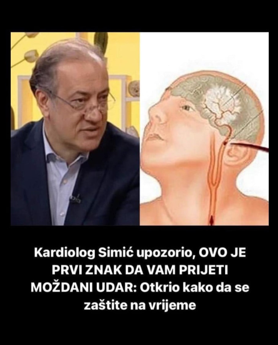 Kardiolog Simić upozorio, OVO JE PRVI ZNAK DA VAM PRIJETI MOŽDANI UDAR: Otkrio kako da se zaštite na vrijeme