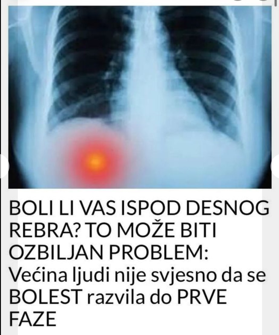 BOLI LI VAS ISPOD DESNOG REBRA? TO MOŽE BITI OZBILJAN PROBLEM: Većina ljudi nije svjesno da se BOLEST razvila do PRVE FAZE