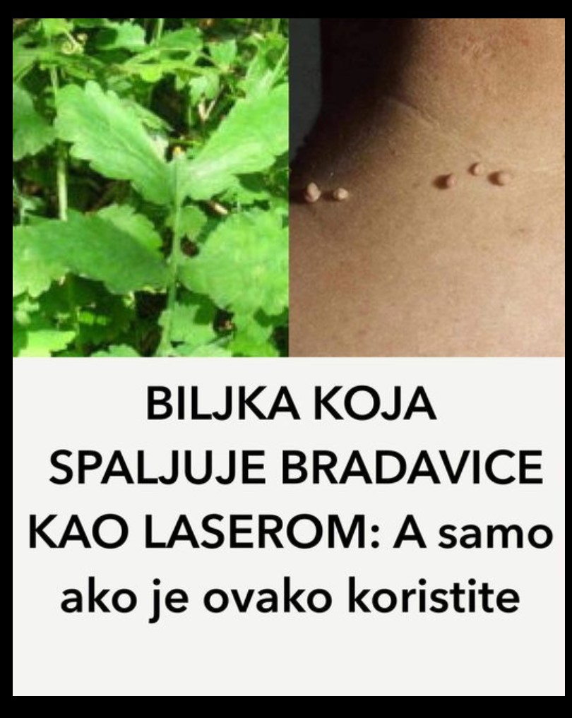 BILJKA KOJA SPALJUJE BRADAVICE KAO LASEROM: A samo ako je ovako koristite