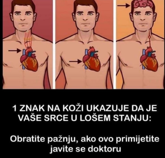 1 ZNAK NA KOŽI UKAZUJE DA JE VAŠE SRCE U LOŠEM STANJU: Obratite pažnju, ako ovo primijetite javite se doktoru