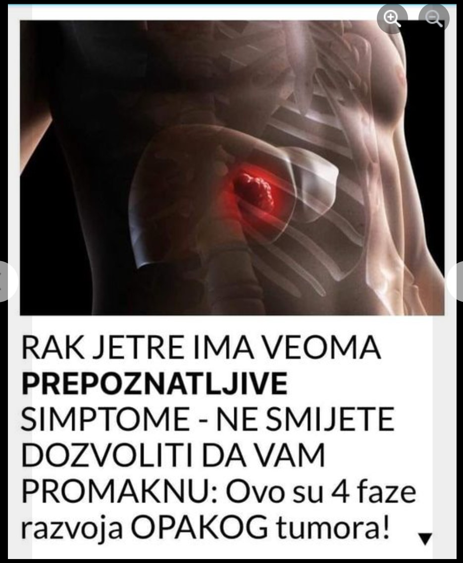 RAK JETRE IMA VEOMA PEPOZNATLJIVE SIMPTOME – NE SMIJETE DOZVOLITI DA VAM PROMAKNU: Ovo Su 4 Faze Razvoja OPAKOG Tumora!￼