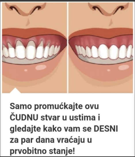 Samo Promućkajte Ovu ČUDNU Stvar U Ustima I Gledajte Kako Vam Se DESNI Za Par Dana Vraćaju U Prvobitno Stanje!