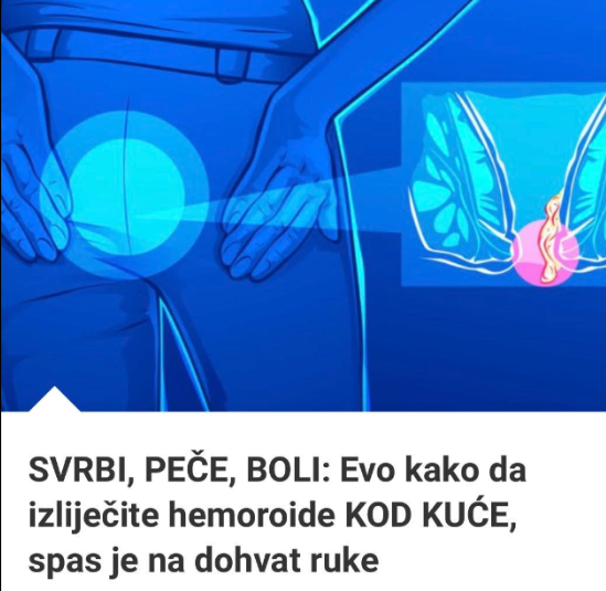 SVRBI, PEČE, BOLI: Evo kako da izliječite hemoroide KOD KUĆE, spas je na dohvat ruke