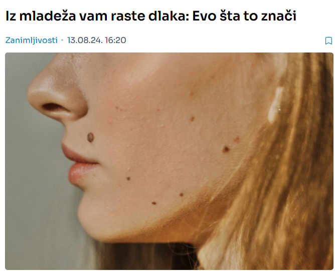 Iz mladeža vam raste dlaka: Evo šta to znači