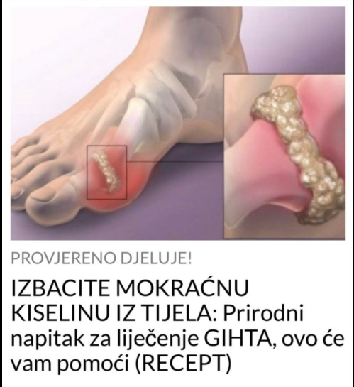 IZBACITE MOKRAĆNU KISELINU IZ TIJELA: Prirodni napitak za liječenje GIHTA, ovo će vam pomoći (RECEPT)