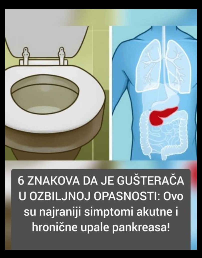 Pankreatitis (upala pankreasa) se najčešće javlja kada dođe