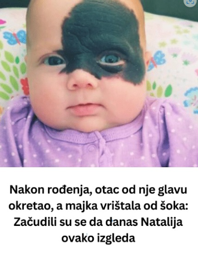 Nakon rođenja, otac od nje glavu okretao, a majka vrištala od šoka: Začudili su se da danas Natalija ovako izgleda