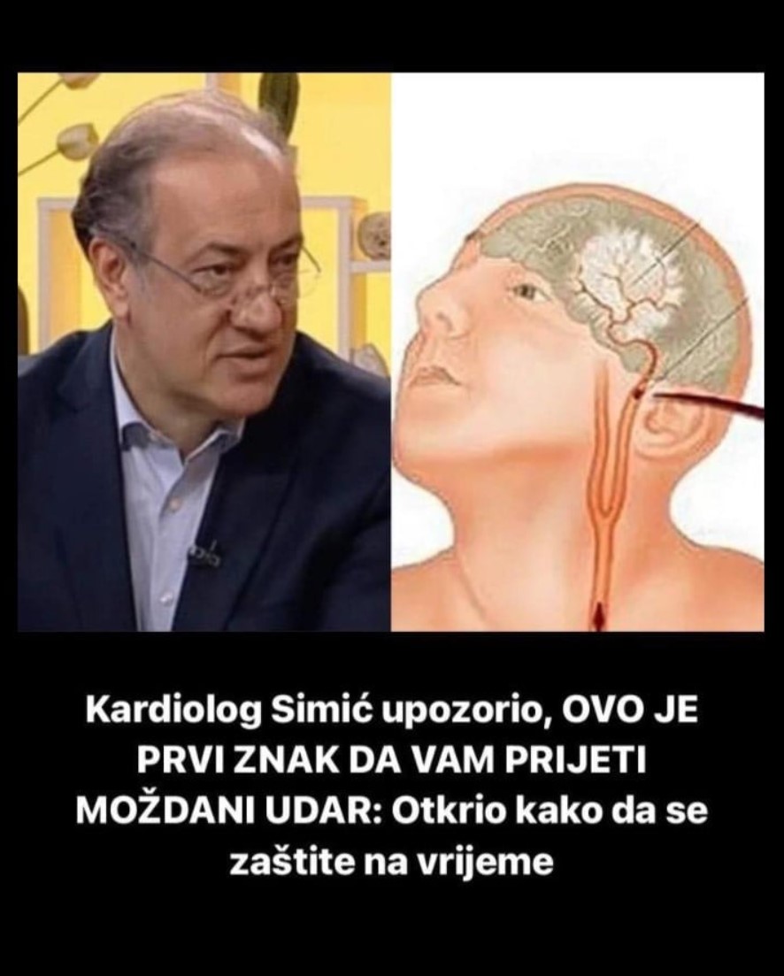 Kardiolog Simić upozorio, OVO JE PRVI ZNAK DA VAM PRIJETI MOŽDANI UDAR: Otkrio kako da se zaštiti na vrijeme