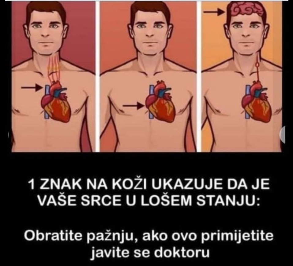 1 ZNAK NA KOŽI UKAZUJE DA JE VAŠE SRCE U LOŠEM STANJU: Obratite pažnju, ako ovo primijetite javite se doktoru