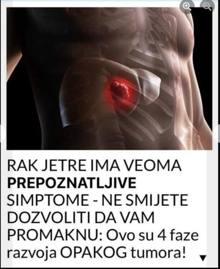 RAK JETRE IMA VEOMA PEPOZNATLJIVE SIMPTOME – NE SMIJETE DOZVOLITI DA VAM PROMAKNU: Ovo su 4 faze razvoja OPAKOG tumora!