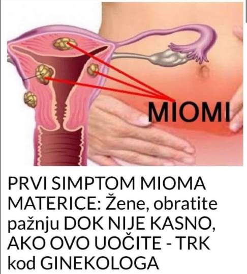 PRVI SIMPTOM MIOMA MATERICE: Žene, obratite pažnju DOK NIJE KASNO, AKO OVO UOČITE – TRK kod GINEKOLOGA