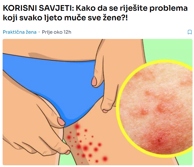 KORISNI SAVJETI: Kako da se riješite problema koji svako ljeto muče sve žene?!