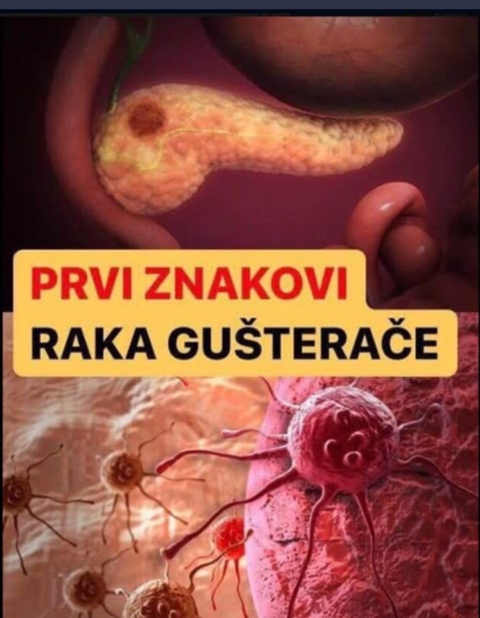 KARCINOM GUŠTERAČE: Ovo je 8 simptoma koje ne smijete ignorisati, ako ih primijetite HITNO KOD DOKTORA DOK NIJE KASNO!