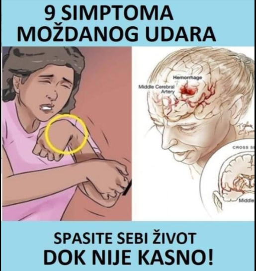 9 SIMPTOMA KOJI UPOZORAVAJU NA MOŽDANI UDAR: Čim osjetite OVO TRČITE DOKTORU – NE ČEKAJTE DA BUDE KASNO