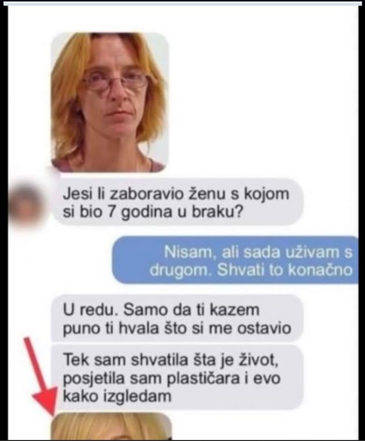 BIVŠI MUŽ ME OSTAVIO NAKON 7 GODINA BRAKA JER SAM SE PRORUŽNILA: A kad je vidio MOJU NOVU SLIKU, oči su mu ispale! (FOTO)