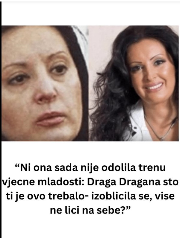 Dragana Mirković i izazov vremena: Estetske promjene ili prirodni tok godina?