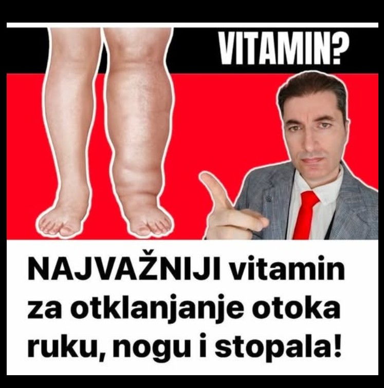 Otekline (edemi): Šta ih uzrokuje i kada treba biti oprezan?