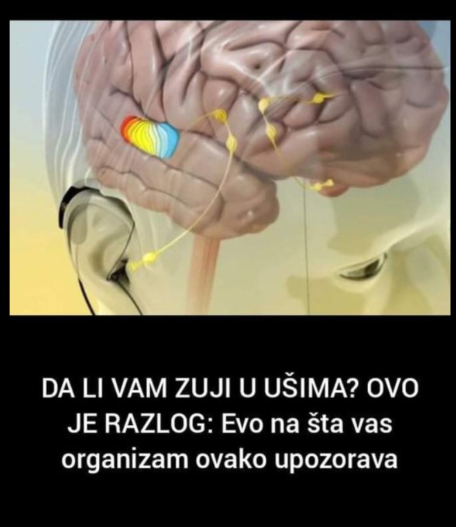 Šta je tinitus i zašto dolazi do zujanja u ušima?