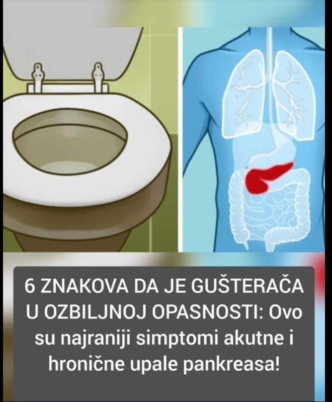 Pankreatitis – uzroci, simptomi, dijagnoza i lečenje