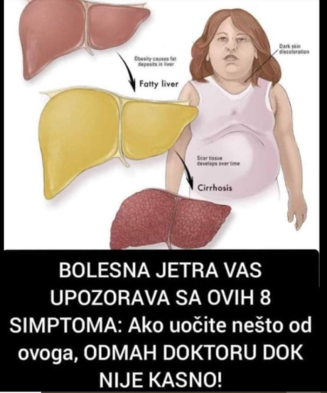 BOLESNA JETRA VAS UPOZORAVA SA OVIH 8 SIMPTOMA: Ako uočite nešto od ovoga, ODMAH DOKTORU DOK NIJE KASNO!