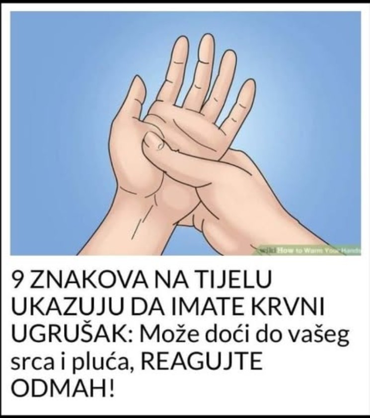 9 ZNAKOVA NA TIJELU UKAZUJU DA IMATE KRVNI UGRUŠAK: Može doći do vašeg srca i pluća, ODMAH REAGUJTE!