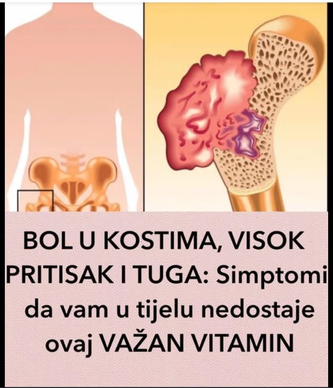 Vitamin D: Zašto je važan i kako prepoznati njegov nedostatak