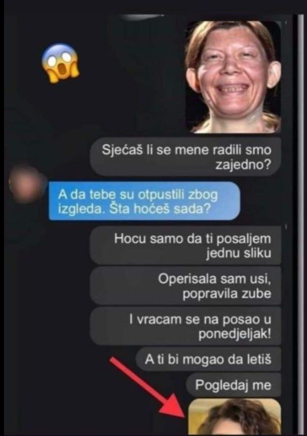 OTJERALI SU ME S POSLA ZBOG IZGLEDA, VRIJEĐALI ME: Sad sam operisala nos, sredila zube i POSLALA KOLEGI SLIKU – SAD MI SE IZVINJAVA (FOTO)