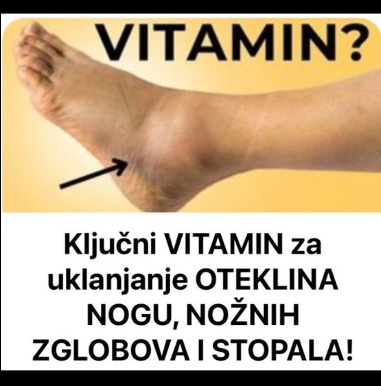Bitni vitamini protiv oticanja nogu,zglobova i članaka
