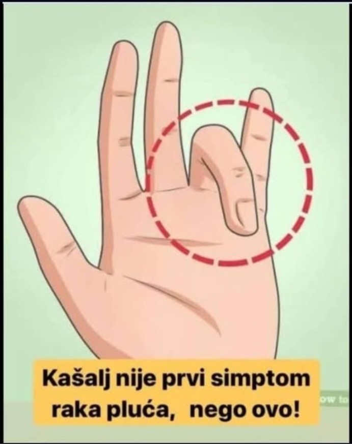 KAŠALJ NIJE PRVI SIMPTOM RAKA, NEGO OVO: Ako ih uočite, treba odmah da se javite doktoru!