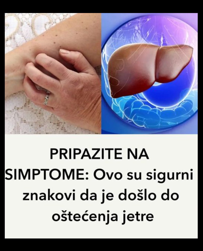 Nealkoholna masna bolest jetre: Tihi izazov modernog doba